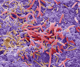 Bacteria Captured through an Electron Scanning Microscope